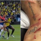 La patada de Domínguez le causó una herida visible en el cuello.