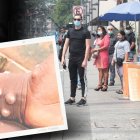 El virus produce pústulas parecidas a la de la varicela. La población se siente ‘relax’.