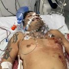 Los médicos trataron de ayudar al herido, pero las balas comprometieron sus órganos.