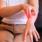 El mal afecta diferentes zonas del cuerpo.