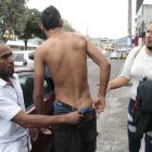 El menor afectado mostró los moretones de los toletazos.