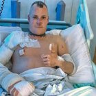 Kevin Record, dueño del can, sufrió algunas quemaduras.