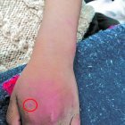 Los doctores lograron estabilizar al niño luego de varios minutos.