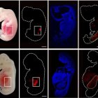Riñones humanos en embriones de cerdo