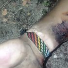 El cadáver tenía signos de violencia.