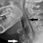 Este ha sido el primer caso registrado en el mundo.
