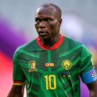 Vincent Aboubakar, de 31 años, se habría realizado el implante capilar en París, Francia.
