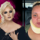 Katty, integrante de la agrupación ‘Las damas de oro’, permanece bajo los cuidados de su esposo.