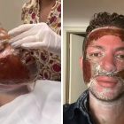 Así quedan los usuarios que se 'arriesgaron' a realizar el tratamiento.