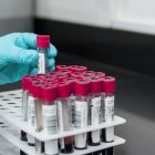Envases de muestras de sangre para su analisis