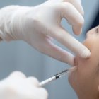 Varios famosos se han sometido a este procedimiento estético