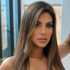 Ámbar Montenegro, tras el procedimiento estético, luce espectacular.