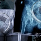 Los investigadores hicieron una revisión y determinaron que las mujeres escondían sustancias ilícitas.