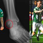 ´Damián Díaz sufrió una lesión del maléolo externo y será operado.