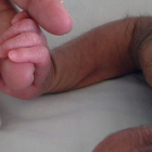 Se detectaron 11 casos en la localidad de Navarra