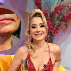 Marián Sabaté sufrió accidente este 20 de abril de 2025