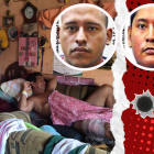 Juan Freire permanece postrado en un mueble, después de recibir una bala perdida en su pierna.