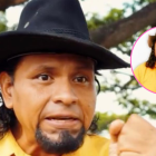 Miguel Santana sufrió la amputación de su pie izquierdo.