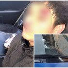 El implicado fue detenido. Un patrullero quedó con daños.