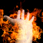 La mujer quedó con varias quemaduras y murió este 13 de mayo.