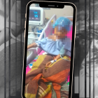 Sinan, de cinco años, ya no podrá caminar ni correr: perdió su pierna izquierda. Él espera por su colaboración para recuperarse y adaptarse.