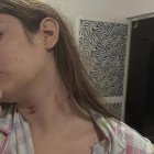 La chonense Nicolle Aray señala a su pareja como responsable de un caso de maltrato y violencia