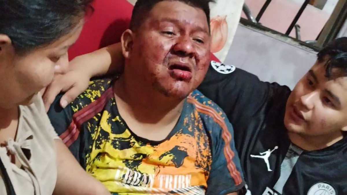 El día de la agresión así encontraron a Italo Sabino Cruz Macías.