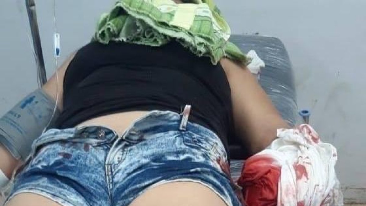 A la mujer le cortaron la mano con un machete.