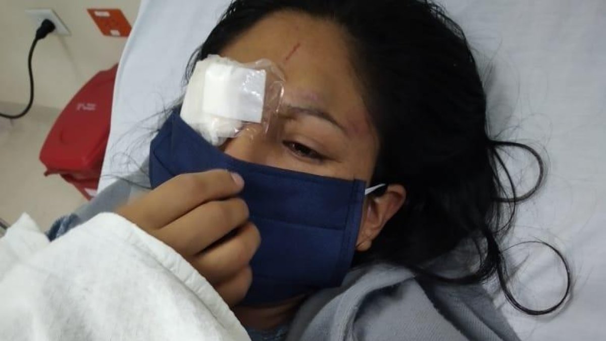 La cotopaxense Jéssica Caicedo Mullo fue atacada en octubre pasado, desde entonces sufre mucho más.