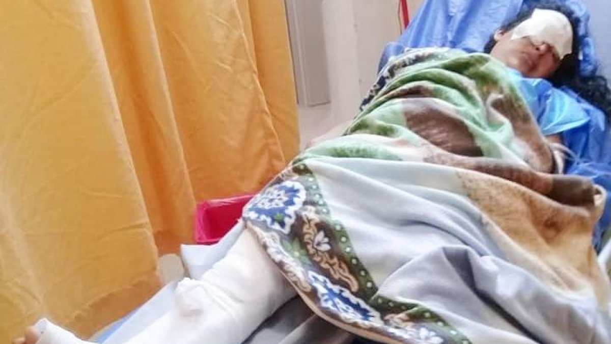 La afectada está internada en el Hospital Marco Vinicio Iza de Lagro Agrio.