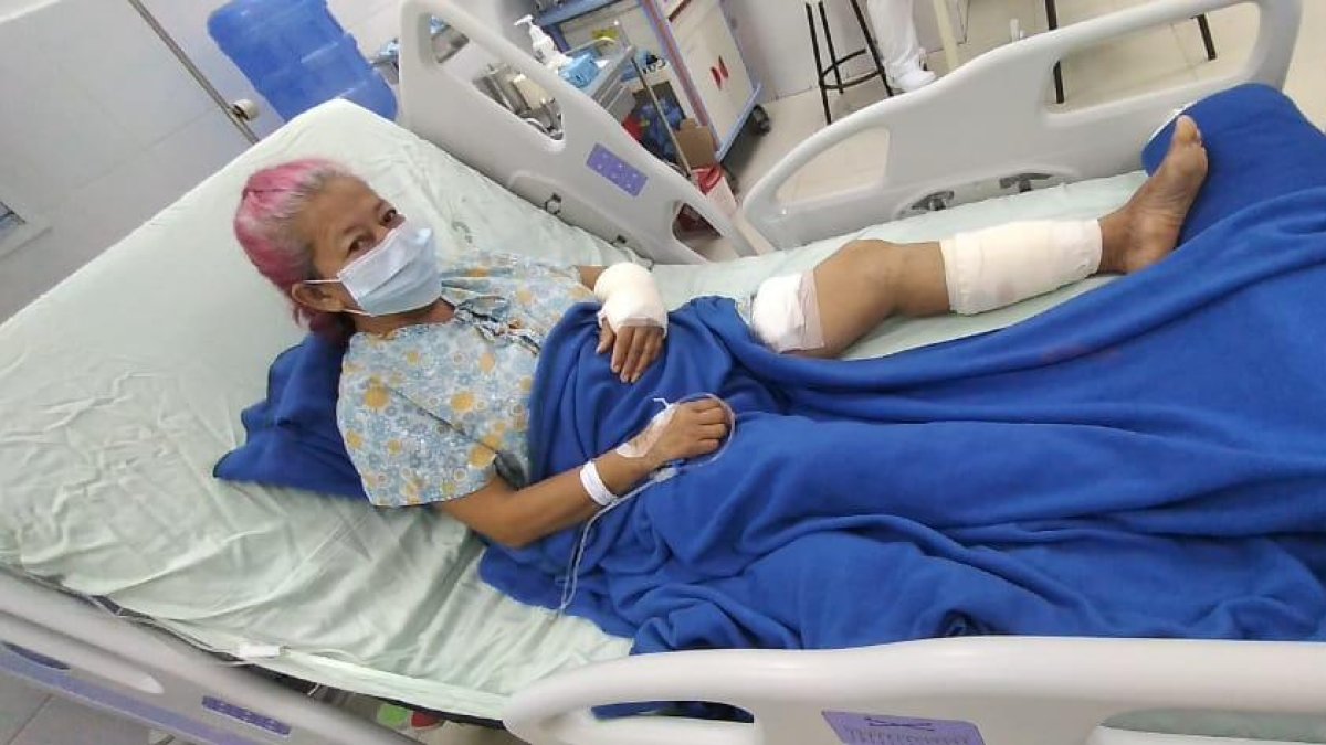 Anita pasó aproximadamente dos semanas en hospitalización.