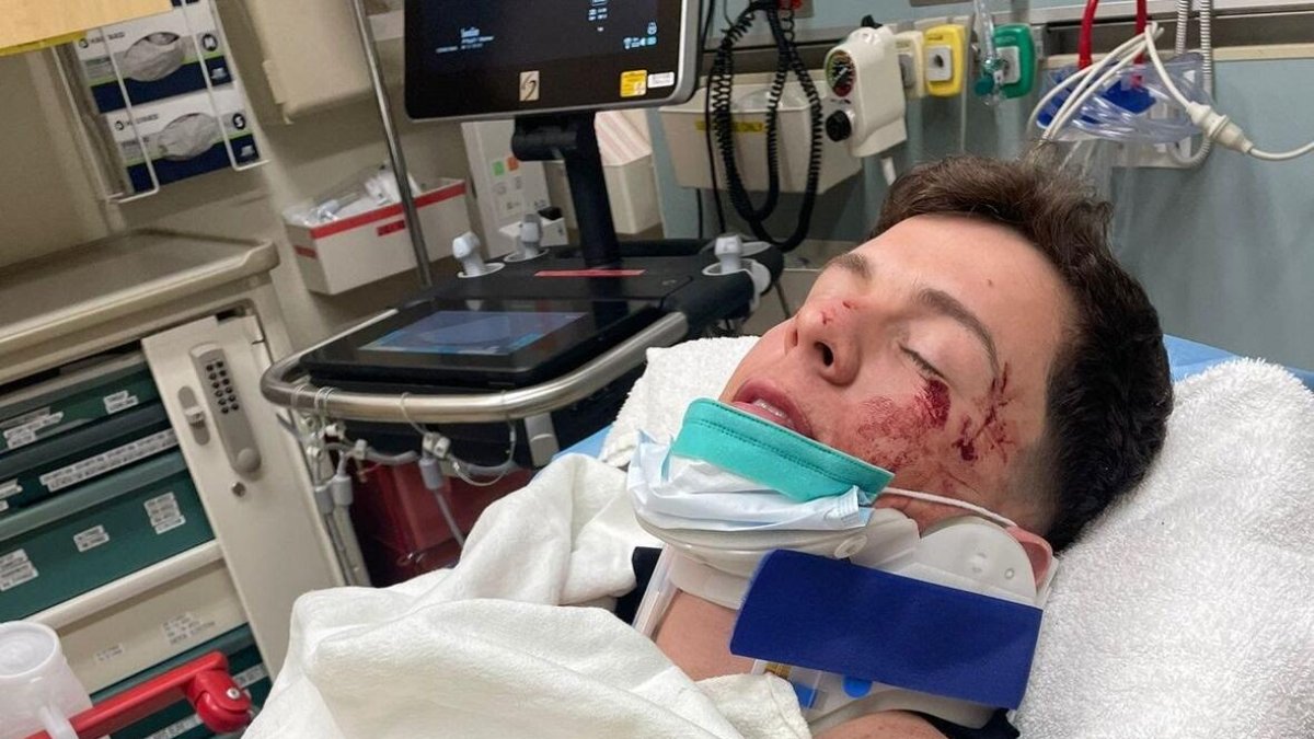 El cantante se encuentra estable luego del siniestro provocado por otro conductor.