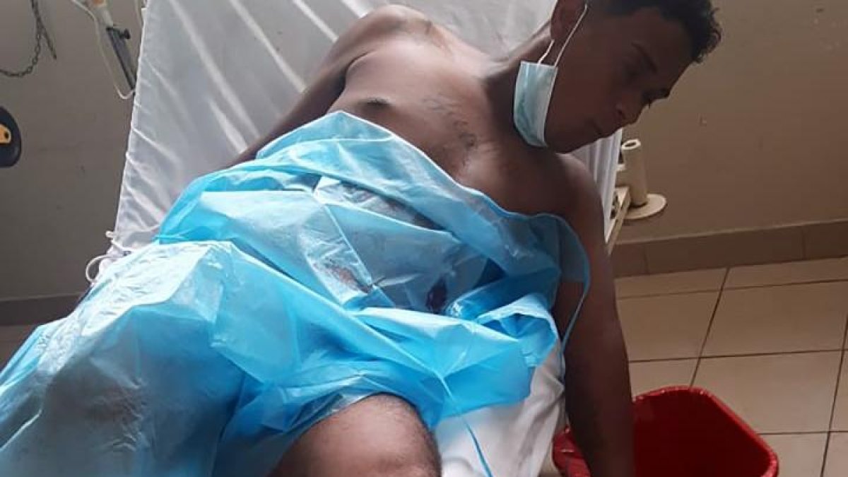 El sospechoso quedó herido en la balacera contra el valeroso policía. Luego de recuperarse escapó de un cuartel policial.