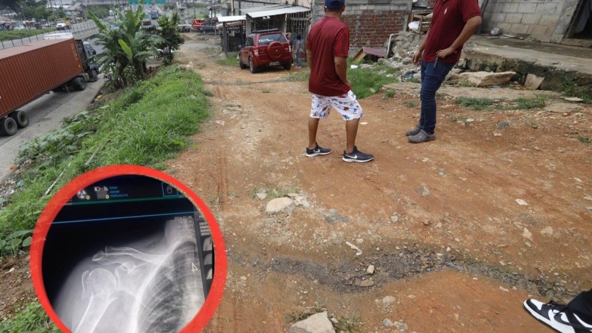 Vecinos mencionan que, con la lluvia, esa calle se convierte en un peligro para los adultos. De hecho, una persona se fracturó el brazo.