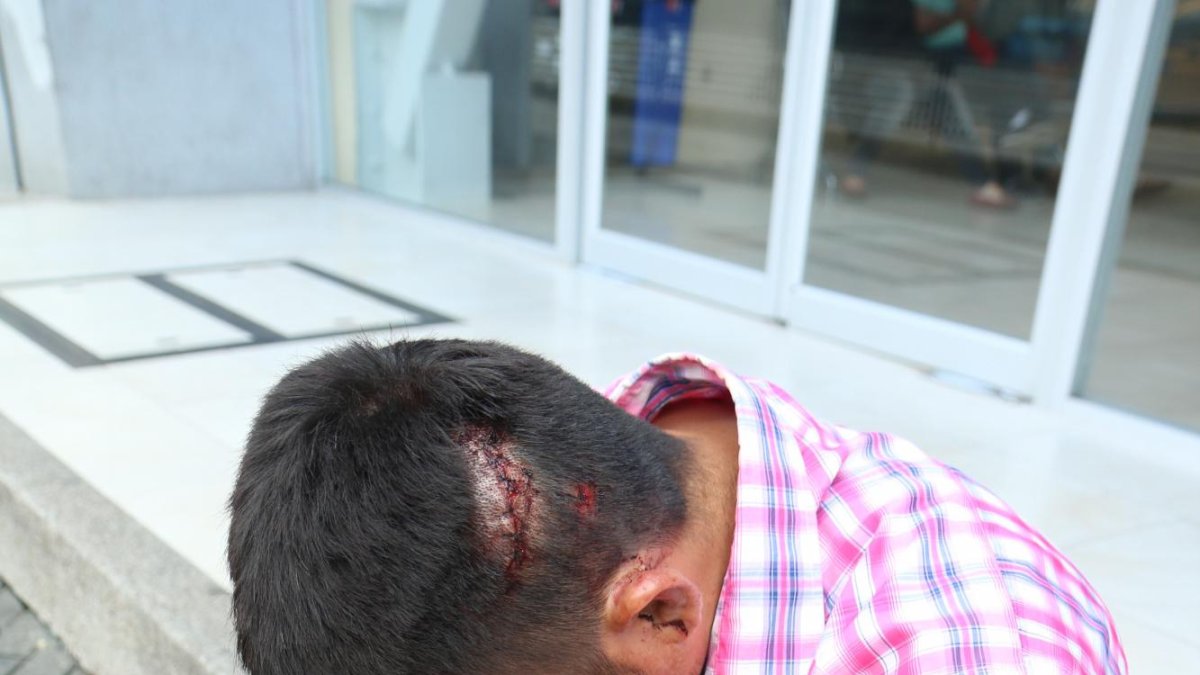 En el lado derecho de su cabeza, Juan tenía una herida aún con manchas de sangre. Debieron suturarle ocho puntos en la zona de corte.