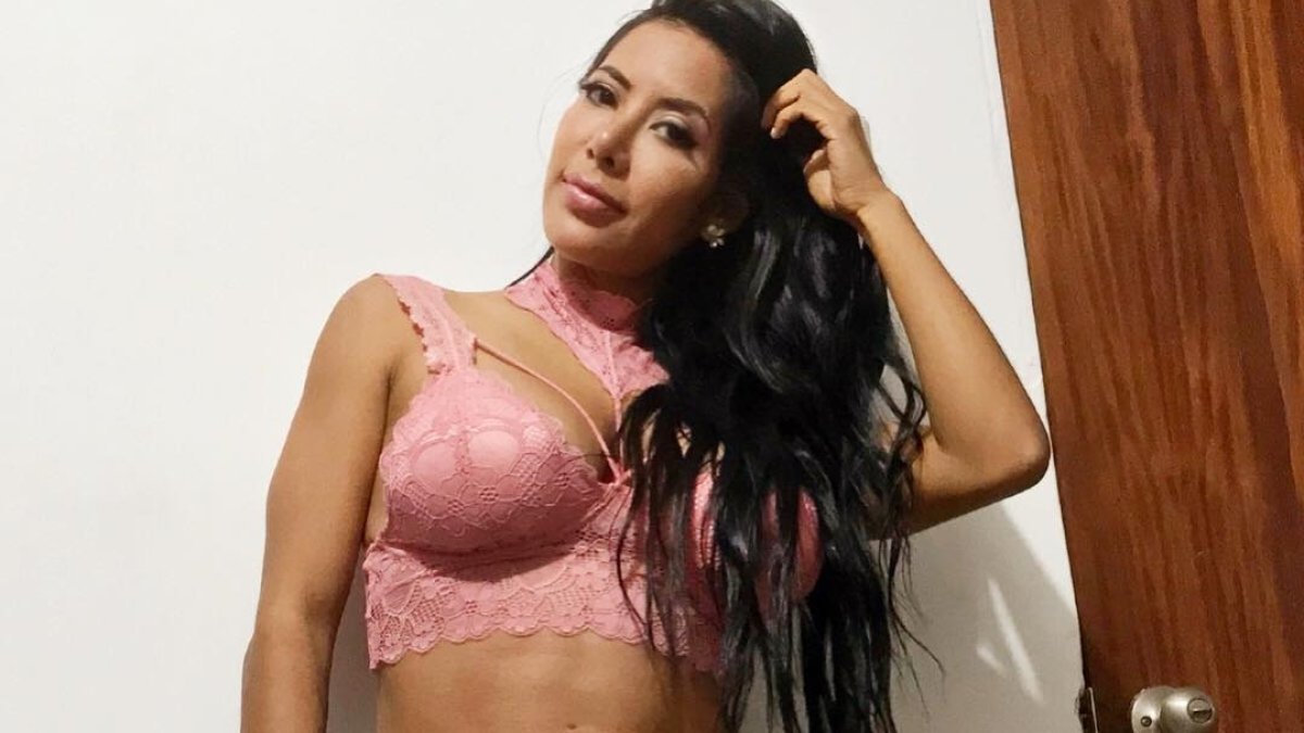 El diagnóstico médico dio como resultado una infección causada en las prótesis mamarias por la presencia de biopolímeros.