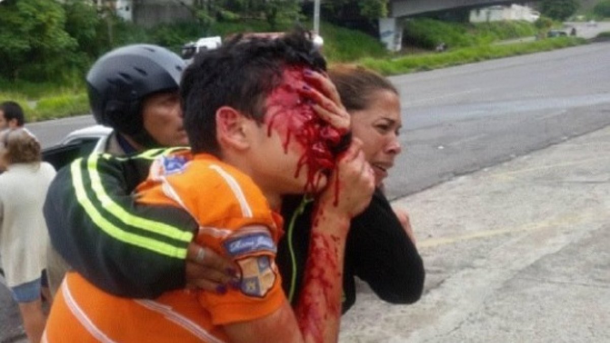 Rufo Chacón intentó quitarse la vida luego de quedar ciego por los perdigones que un policía venezolano le disparó.