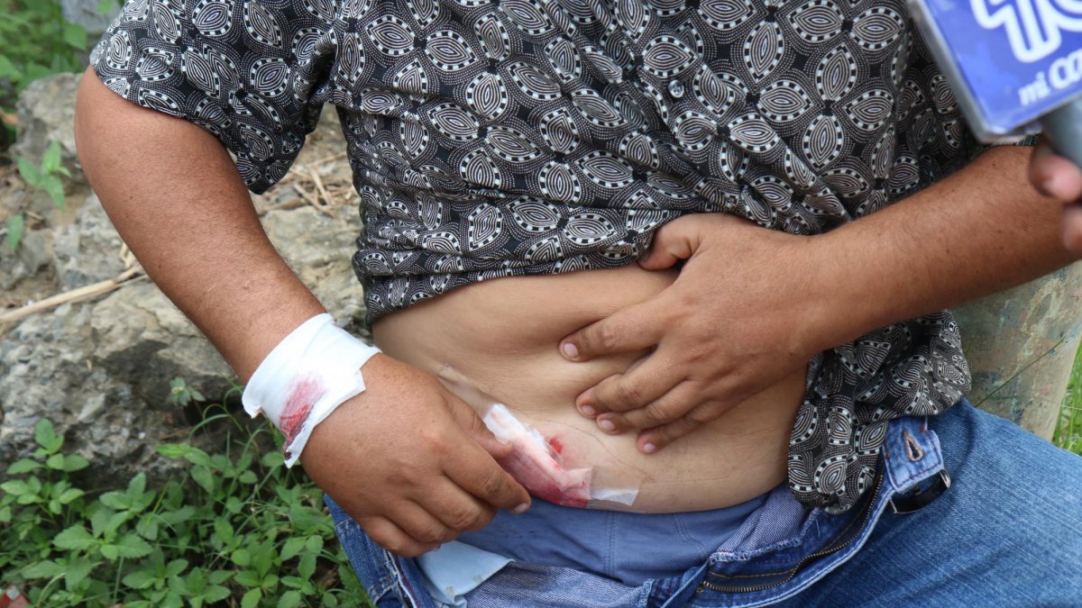 El morador recibió un disparo en la mano derecha. El tiro salió y se alojó en su abdomen. El hombre está estable.