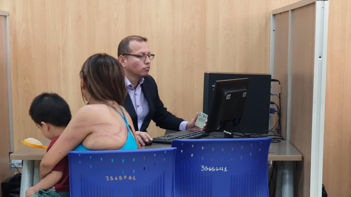 La mujer presenta marcas en su cuerpo, reflejo del cruel ataque del que fue víctima.
