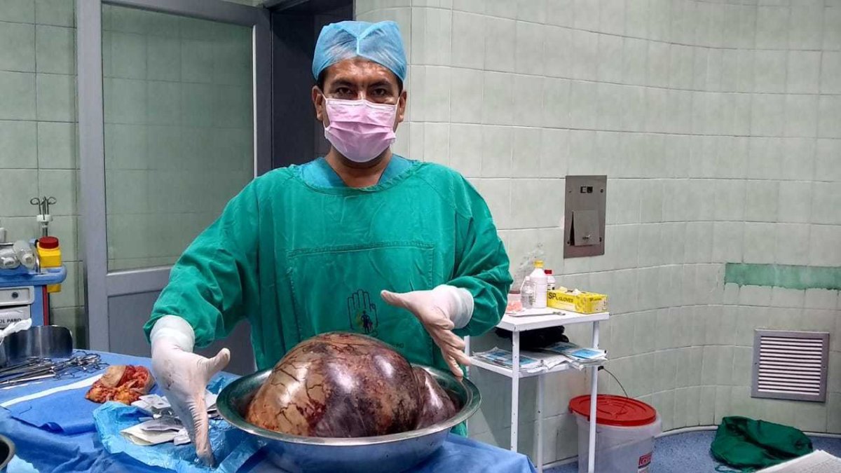 Había varios riesgos al sacar el tumor que comprimía los órganos de la paciente.