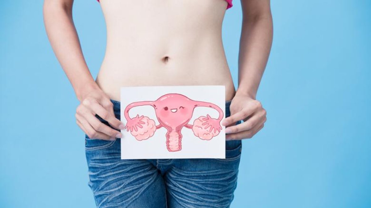 Los tumores de ovarios más frecuentes son el cistoadenoma, que es tumor benigno y el cistoadenoma carcinoma, que es el tumor maligno.