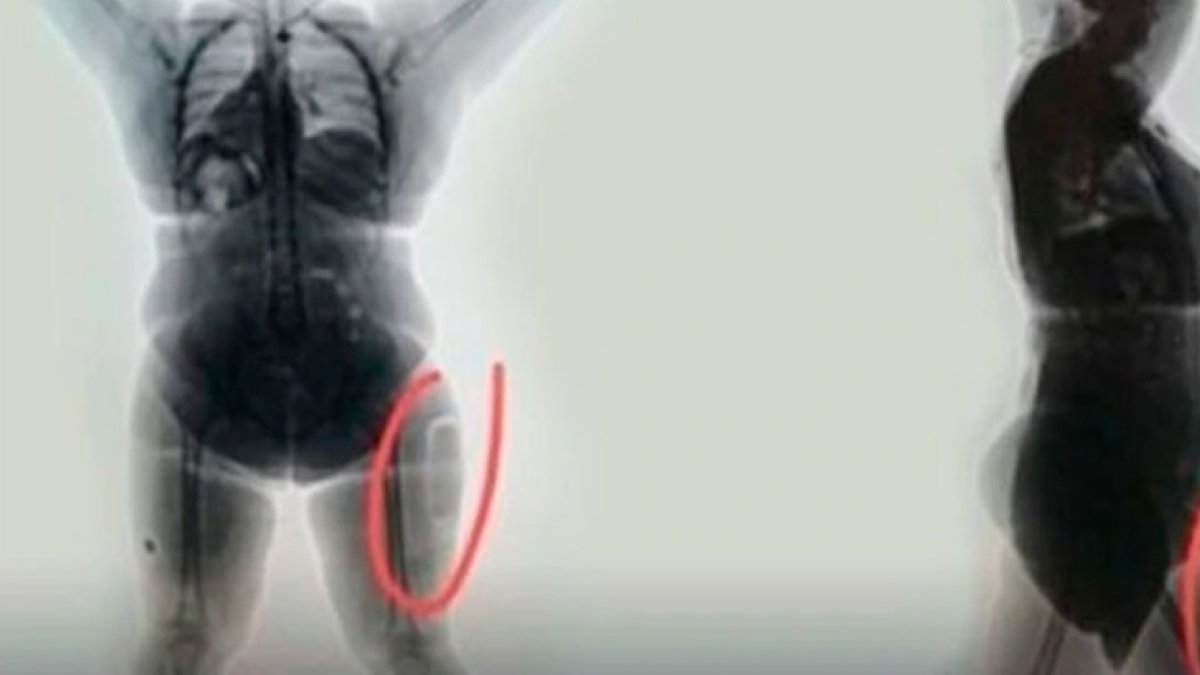 Mujer es arrestada por traficar droga en sus muslos.