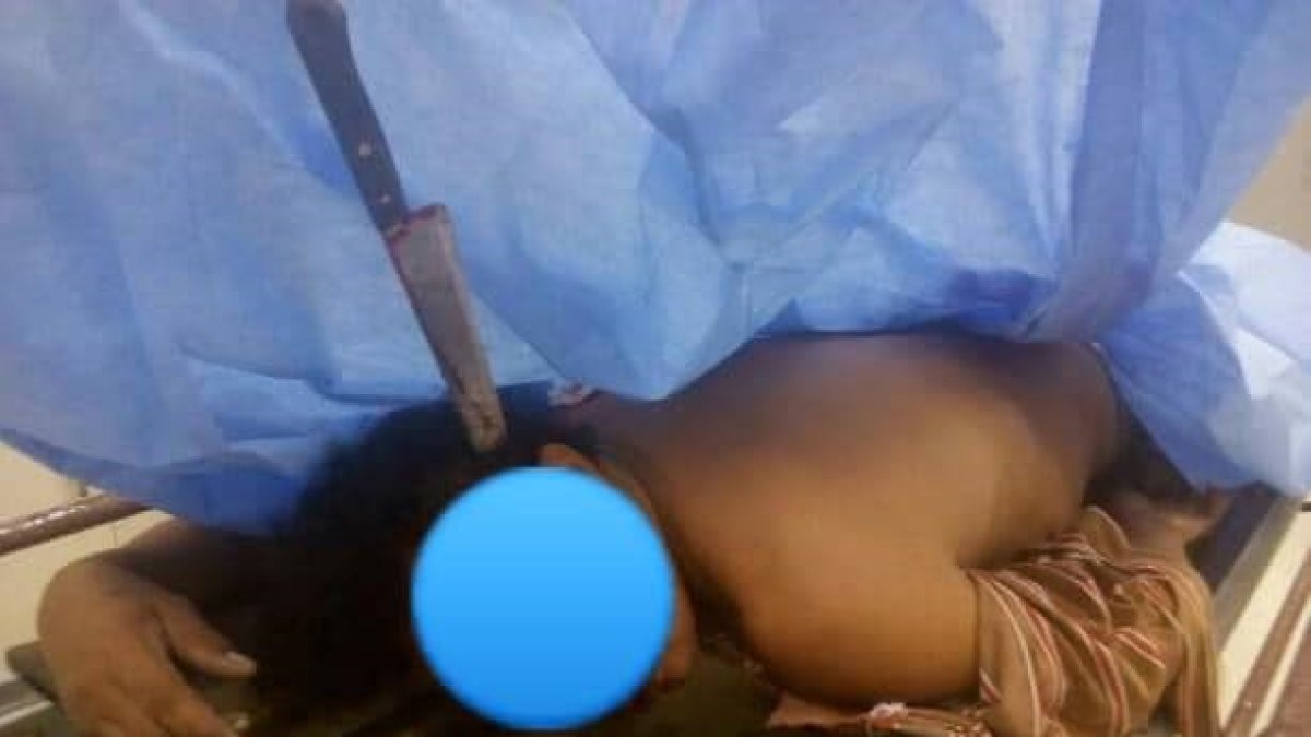El hombre quedó con un cuchillo de 25 centímetros clavado en su cabeza