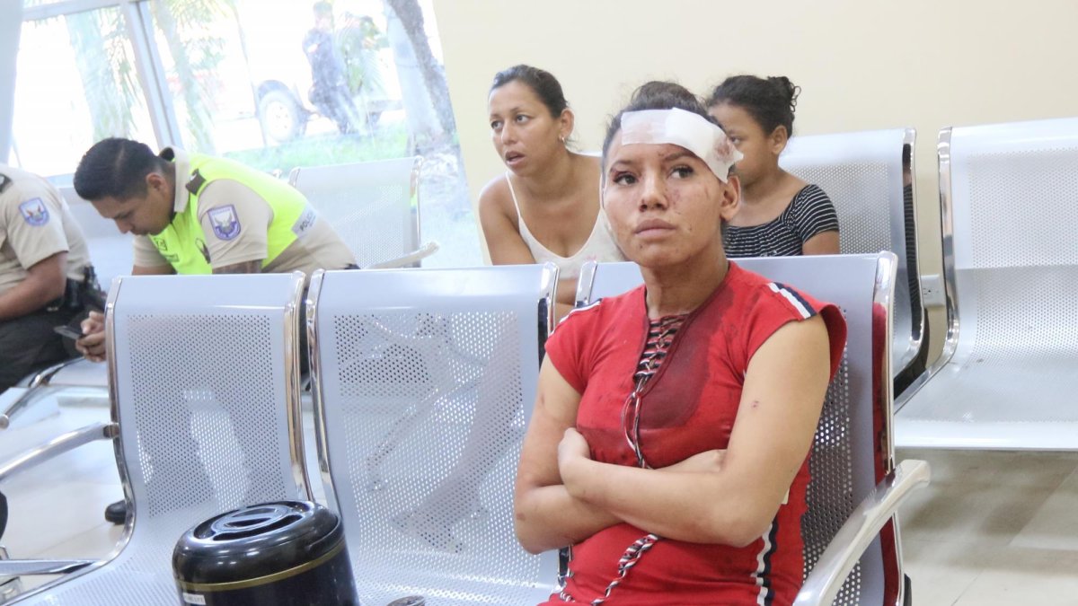 La joven agredida fue a la Fiscalía a denunciar el caso. Una gasa en su frente cubría su herida.