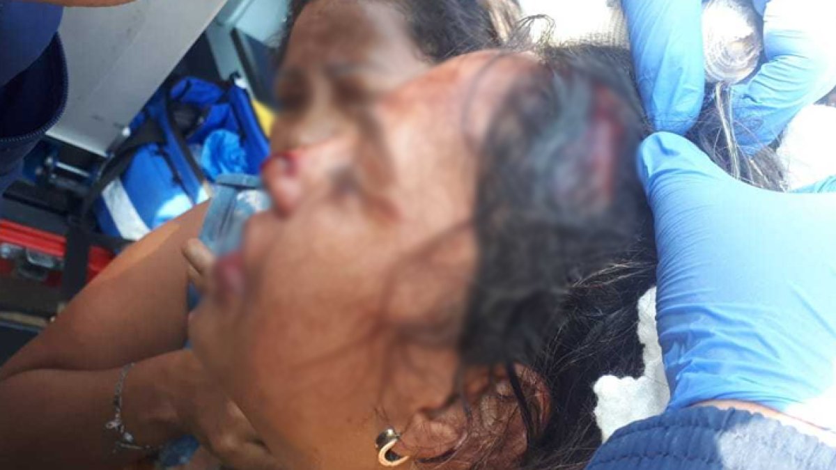 Carolina fue llevada hasta el hospital de Monte Sinaí donde recibió la atención médica. Tenía un corte en el lado izquierdo de su cabeza, en el rostro y en uno de sus brazos.