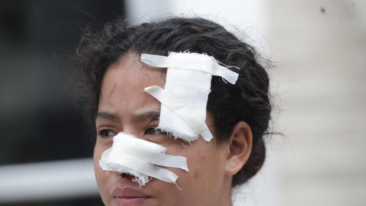Las heridas de la muchacha están cubiertas con esparadrapo.