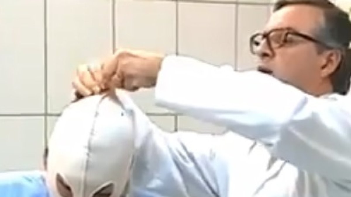 El hombre llegó al centro de salud con el 85 % de su cuerpo quemado.