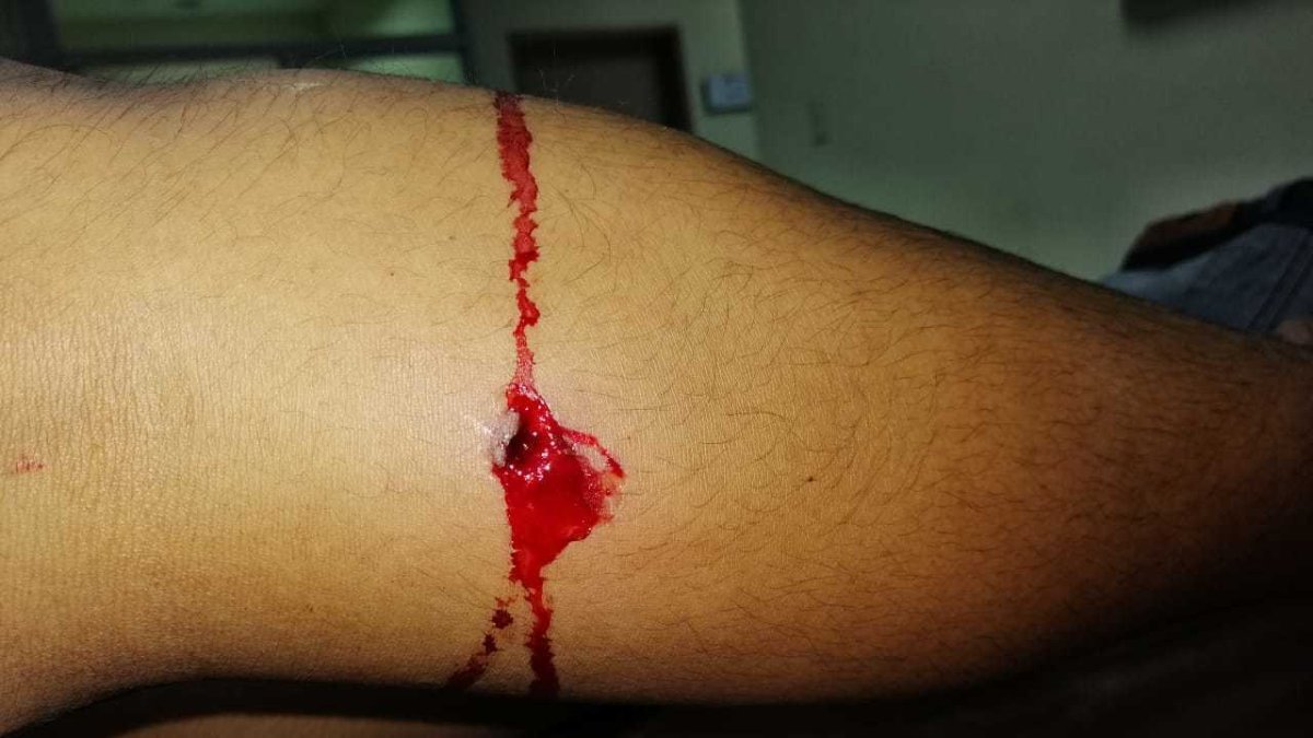 El herido fue llevado a una casa asistencial donde se recupera.