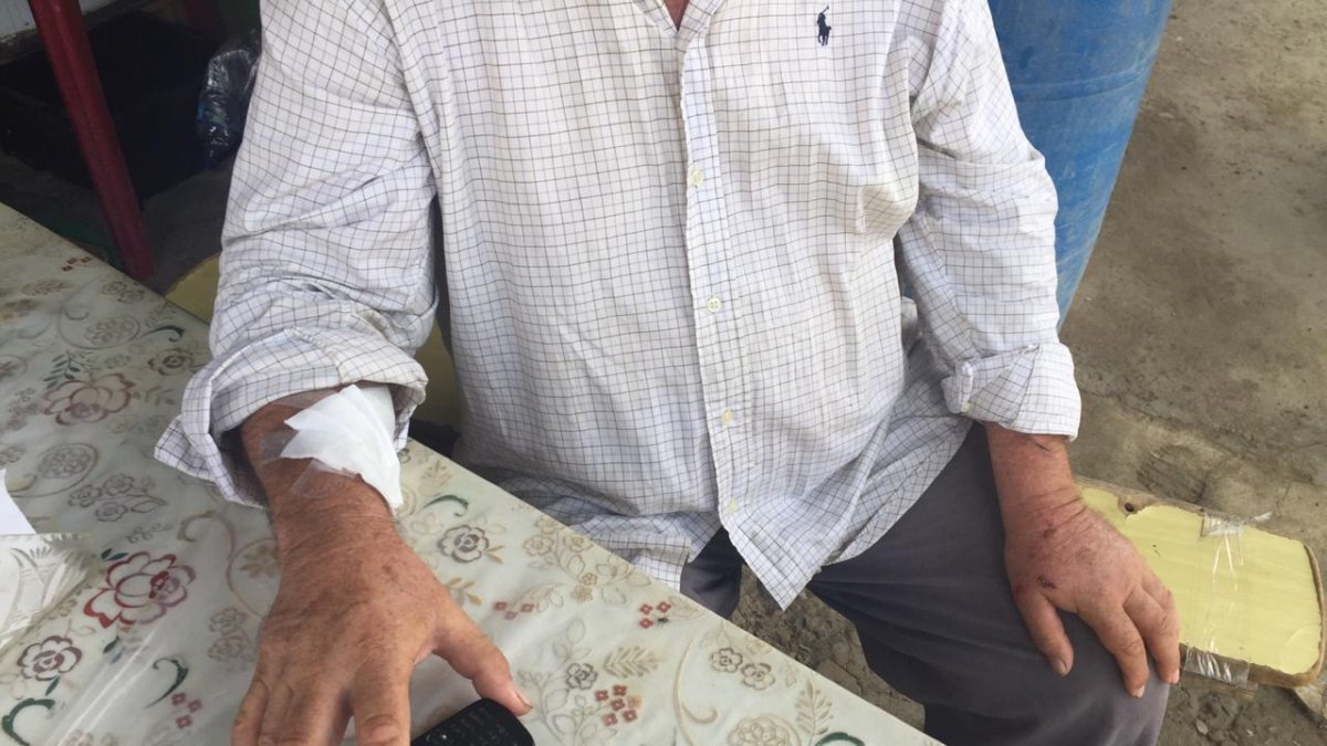 El conductor agredido muestra una de las heridas provocada por los delincuentes, además del celular que no pudieron llevársele.