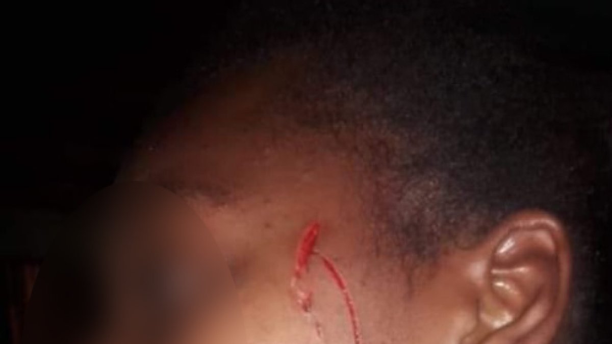 Usando una hoja para afeitar, la sospechosa le propinó cuatro cortes en el rostro de la menor.